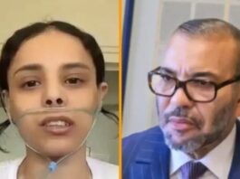 Santé au Maroc : Greffe pulmonaire
