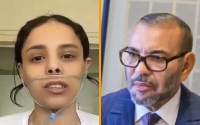 Santé au Maroc : Greffe pulmonaire