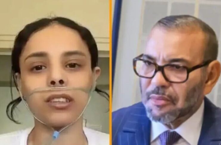 Santé au Maroc : Greffe pulmonaire